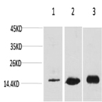 MAP LC3B Polyclonal Antibody