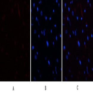 E2F-1 Polyclonal Antibody