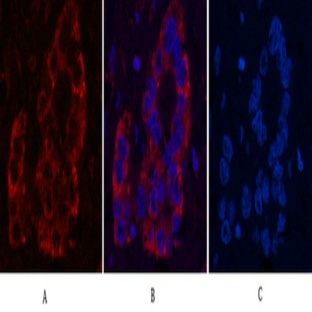 I?B ? Monoclonal Antibody