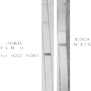 I?B-? (phospho Ser32/S36) Polyclonal Antibody