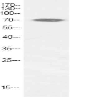 p70 S6 kinase ? Polyclonal Antibody