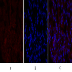 PERK Polyclonal Antibody