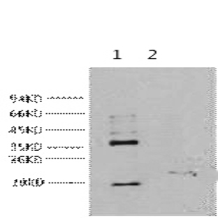 CA IX Monoclonal Antibody