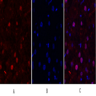 FAK Polyclonal Antibody