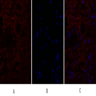 IL-8 Polyclonal Antibody