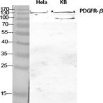 PDGFR-? Polyclonal Antibody