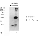 TIMP-1 Polyclonal Antibody