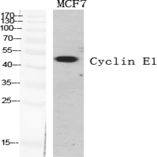 Cyclin E1 Polyclonal Antibody