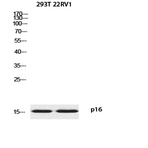 p16 Polyclonal Antibody