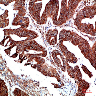 PTEN Polyclonal Antibody