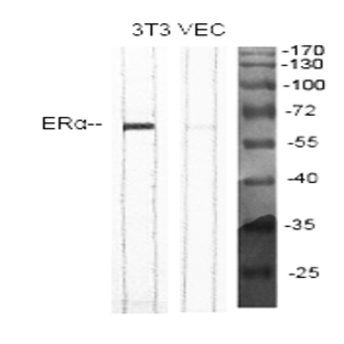 ER? Polyclonal Antibody