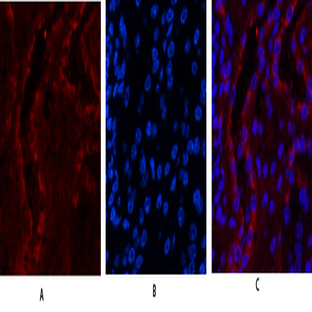 ER? Polyclonal Antibody