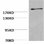 Fibronectin Monoclonal Antibody