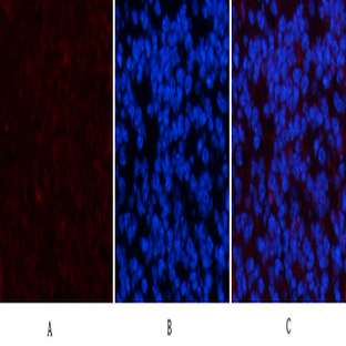 PDGFR? Mouse Monoclonal Antibody(7A3)