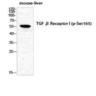 TGF? RI (phospho Ser165) Polyclonal Antibody