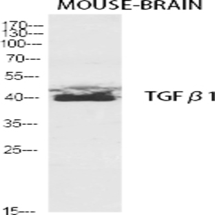 TGF?1 Polyclonal Antibody