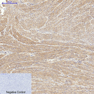 Actin ? Polyclonal Antibody